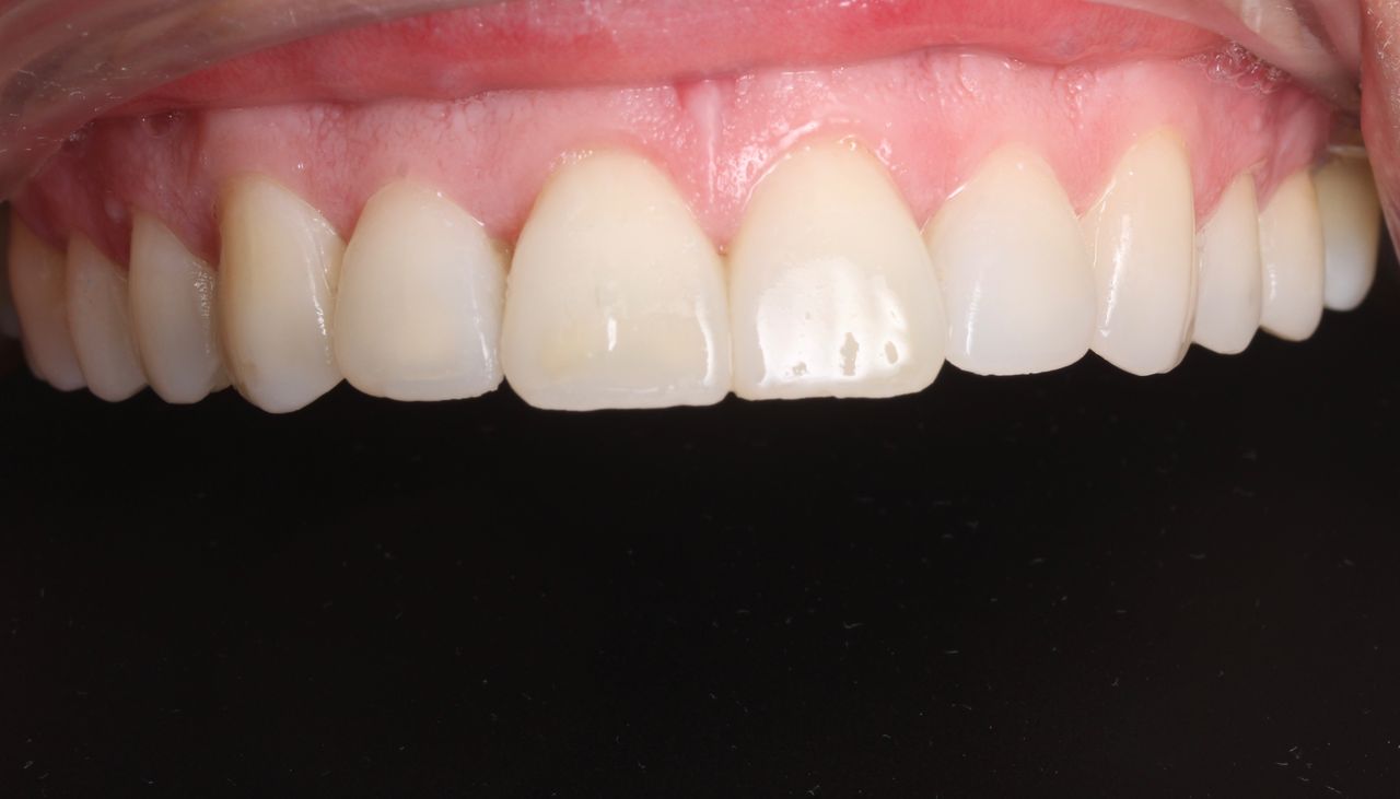 Luis Angel Carranza Resendez-2