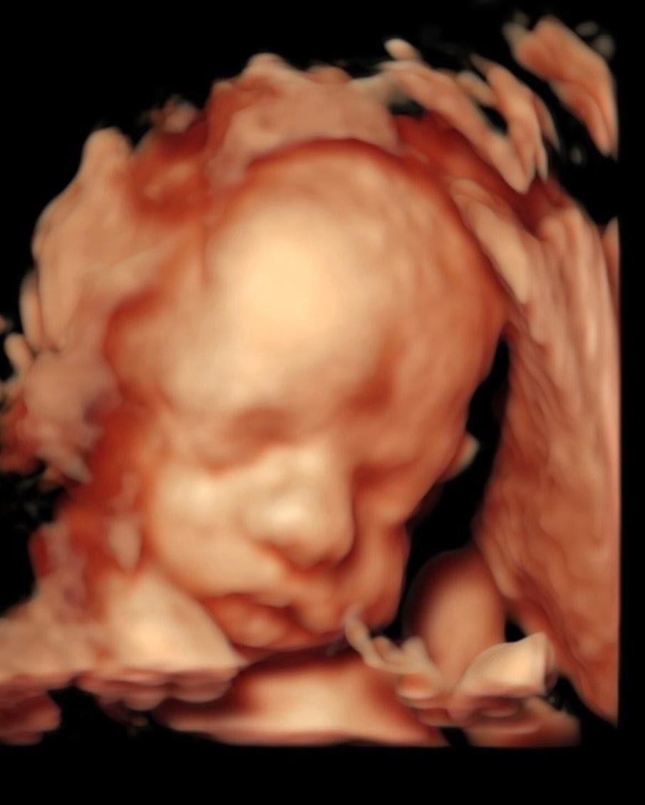 Juan Carlos De León-6