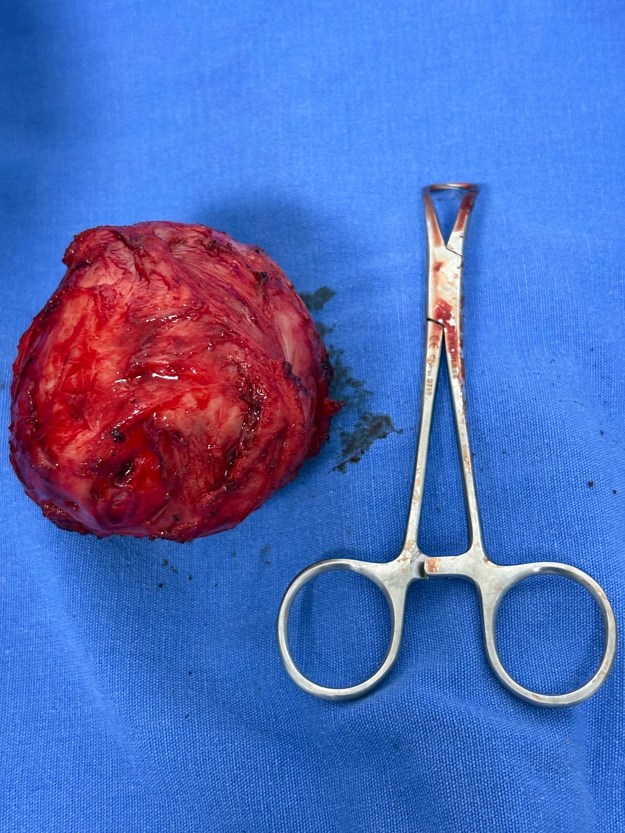 Miriam Yusely Sánchez Tafoya-10