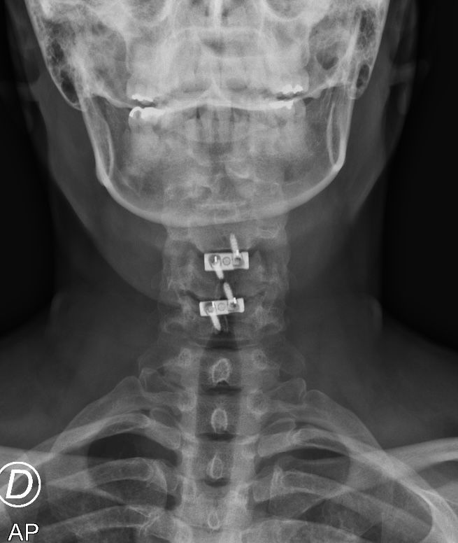 Raúl Lozano Madrigal-2