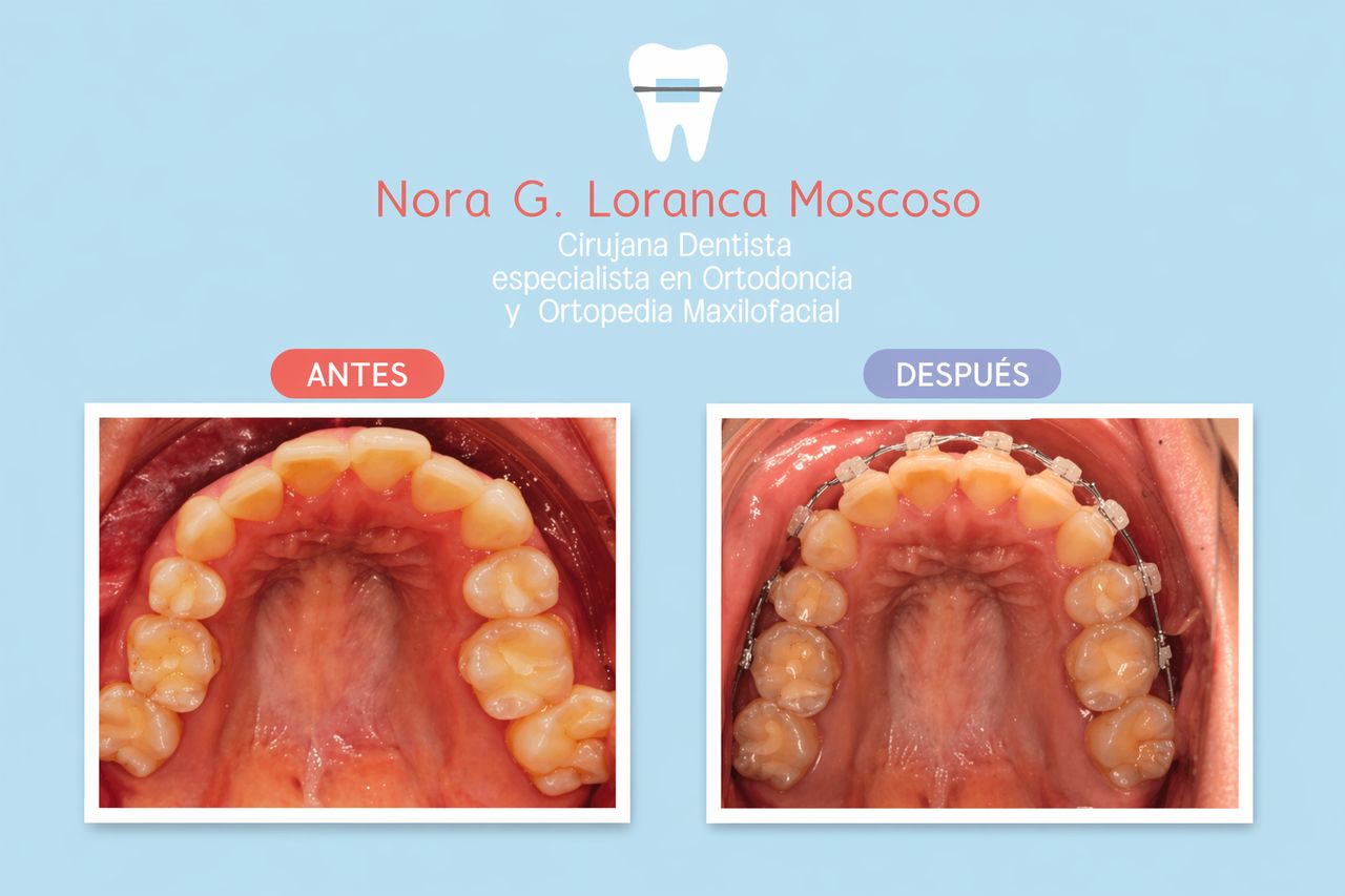Nora Gabriela Loranca Moscosa-4