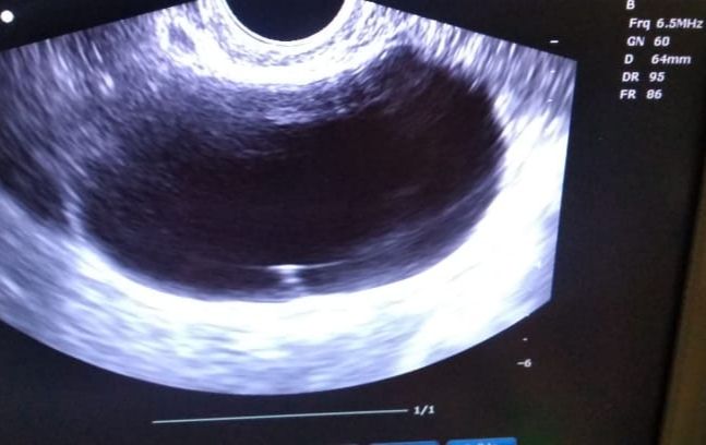 Germán Gabriel Palacios López-32