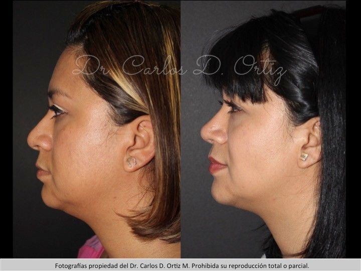 Carlos David Ortiz Moreno-21