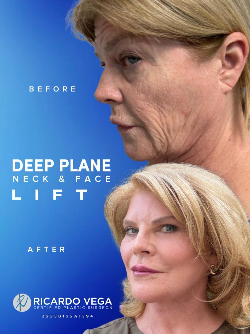 Ricardo Vega Montiel-4