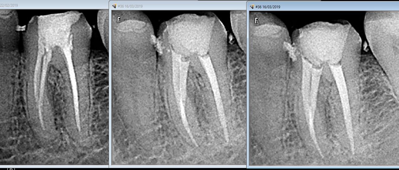 Lesli Erendira Campechano Zaragoza-16