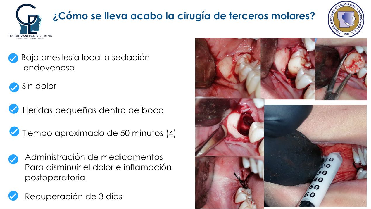 Giovani Ramírez Limón-32