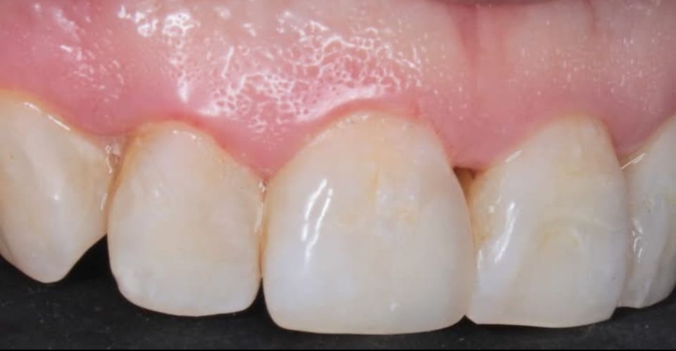 Carlos Enrique Hernández Rodríguez-10