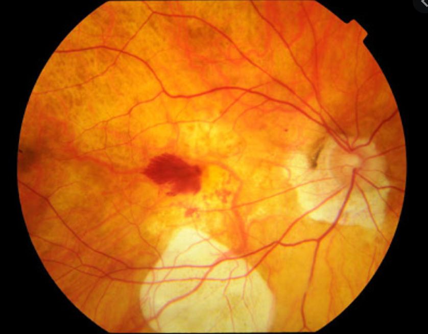 Juan Fernando Rivero Prado-4