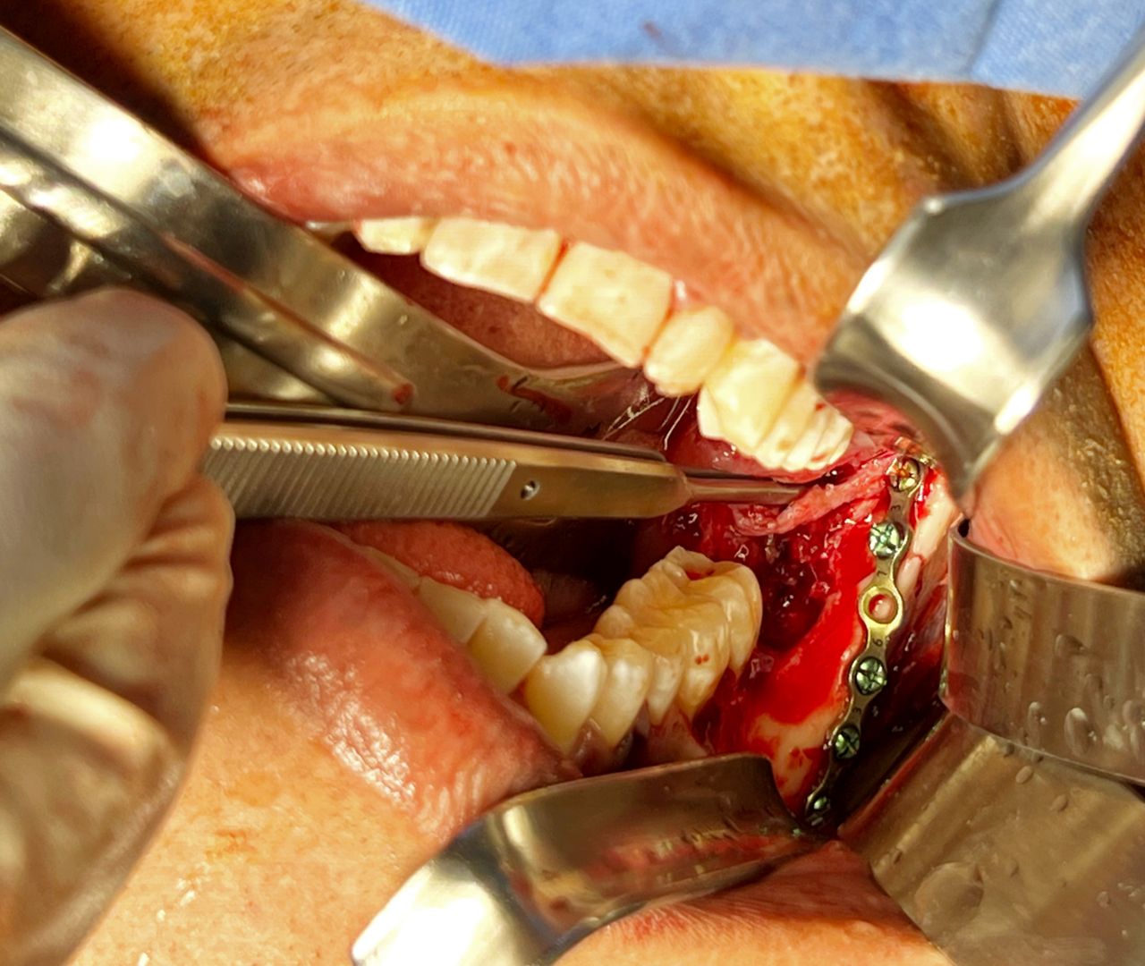 Christian San Juan González-17