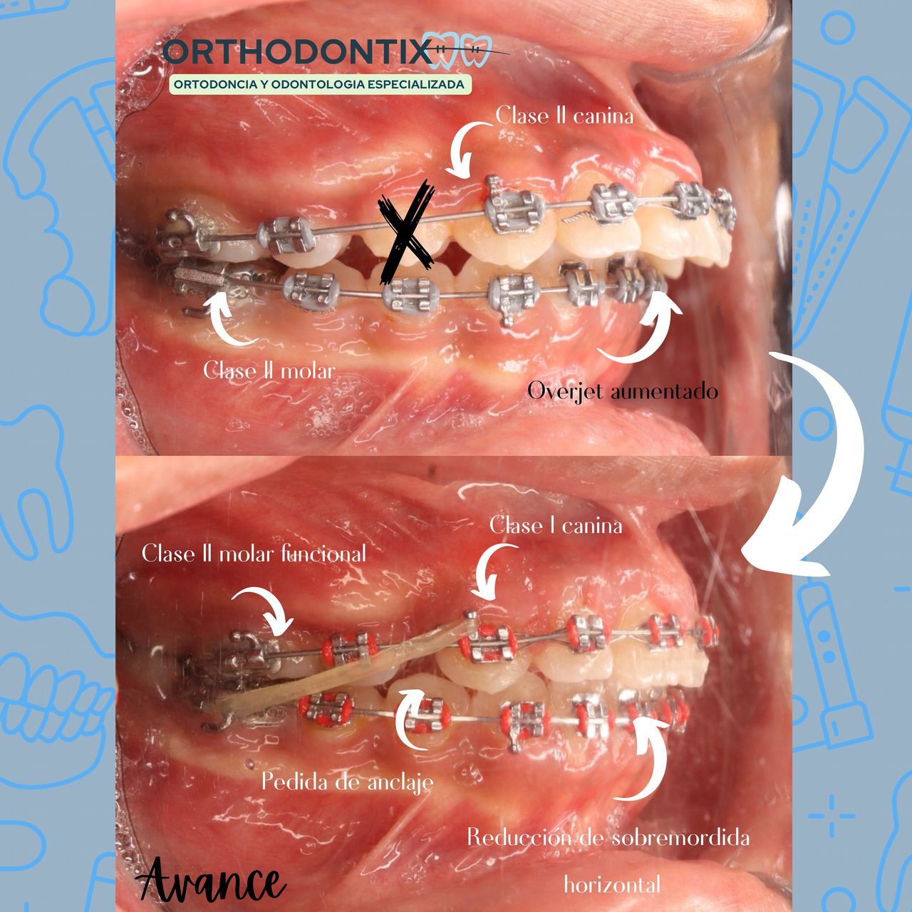 Diego García Campillo-4