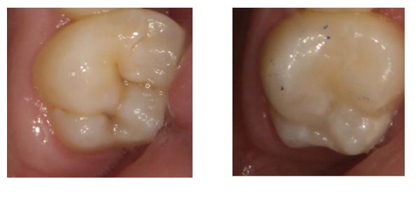 Andrea Hernández Garcia-13