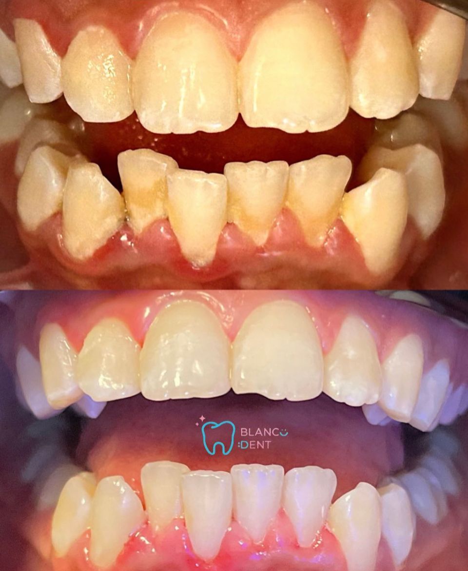 Karen Monserrat Gomez Reyes-25