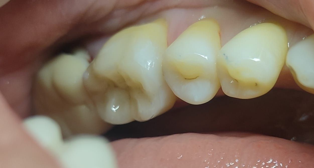 Jonathan Manuel Morán Castell-51