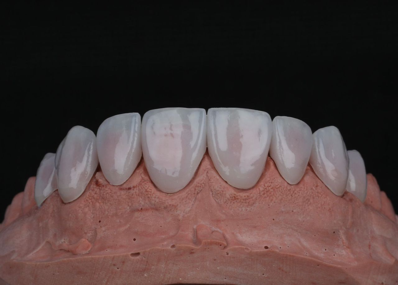 Janeth Arzate Banda-6