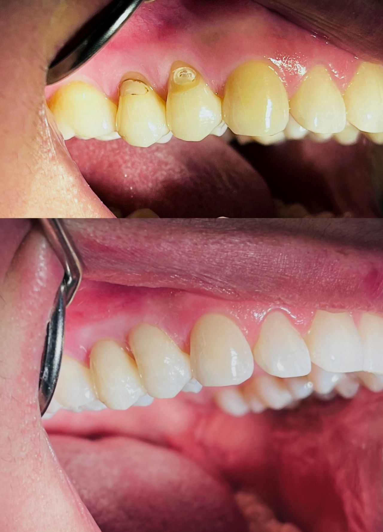 Ulises Alvarado Rodríguez-15