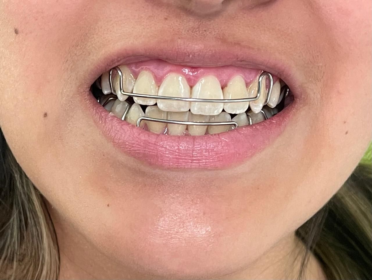 Anuar Becerril Castro-3