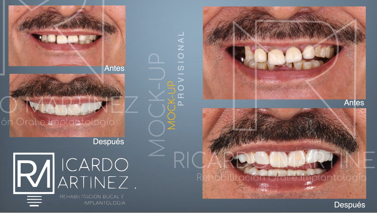 J. Ricardo Martínez-1