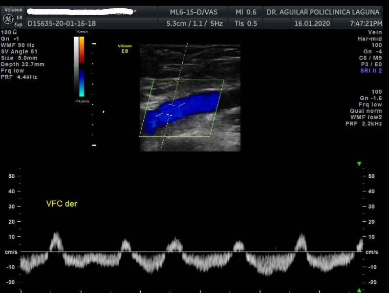 Edgar Fernando Aguilar Morales-12