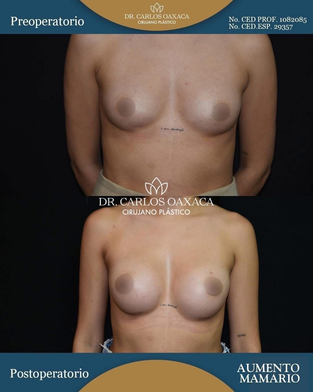 Carlos Guillermo Oaxaca Escobar-0