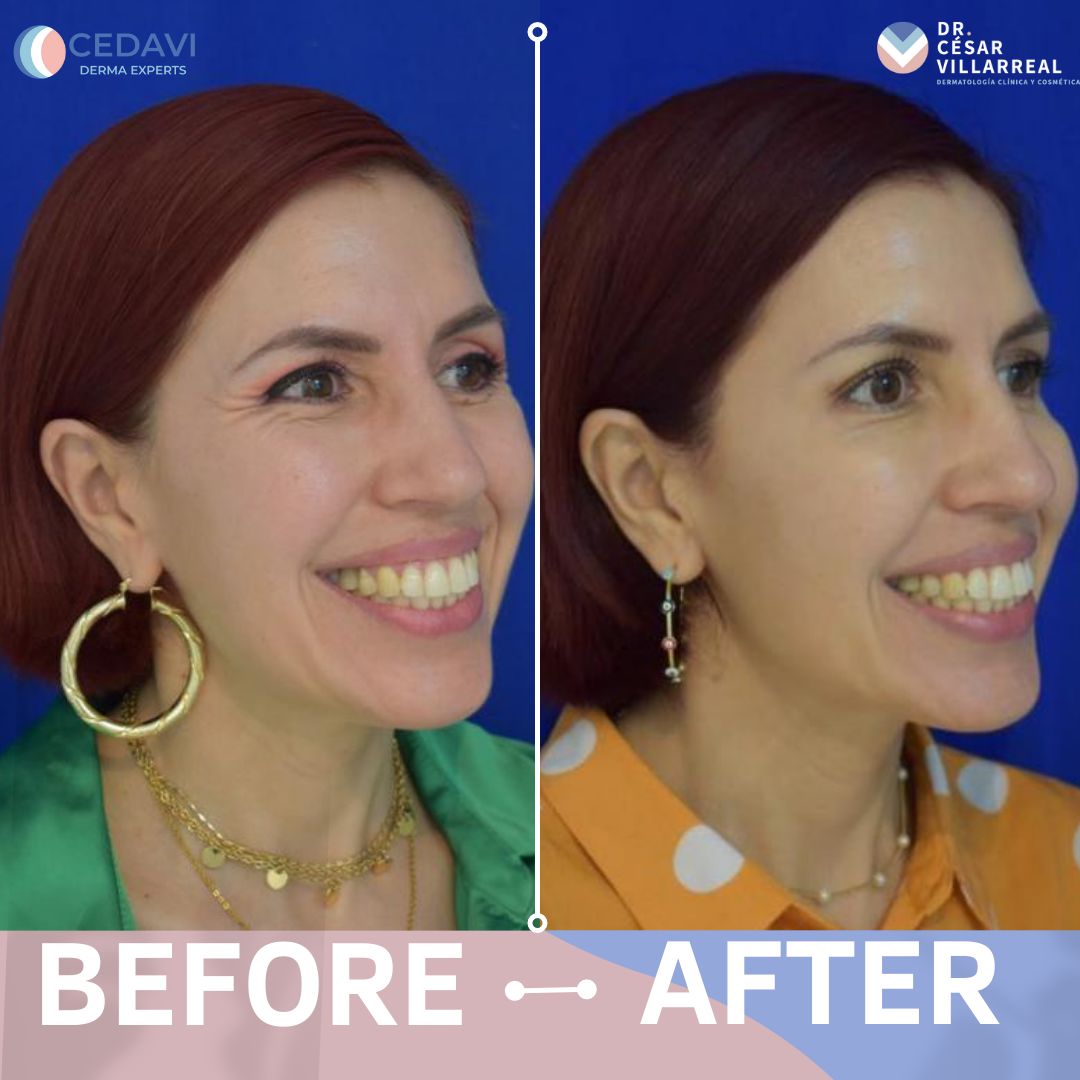 César Daniel Villarreal Villarreal-9