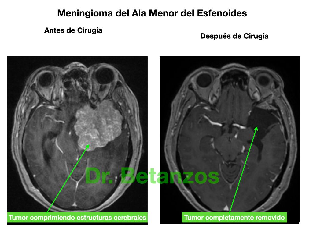 Aleixandre Betanzos Villegas-1