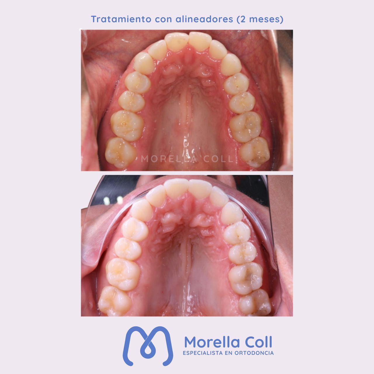 Morella Coll Mibelli-12