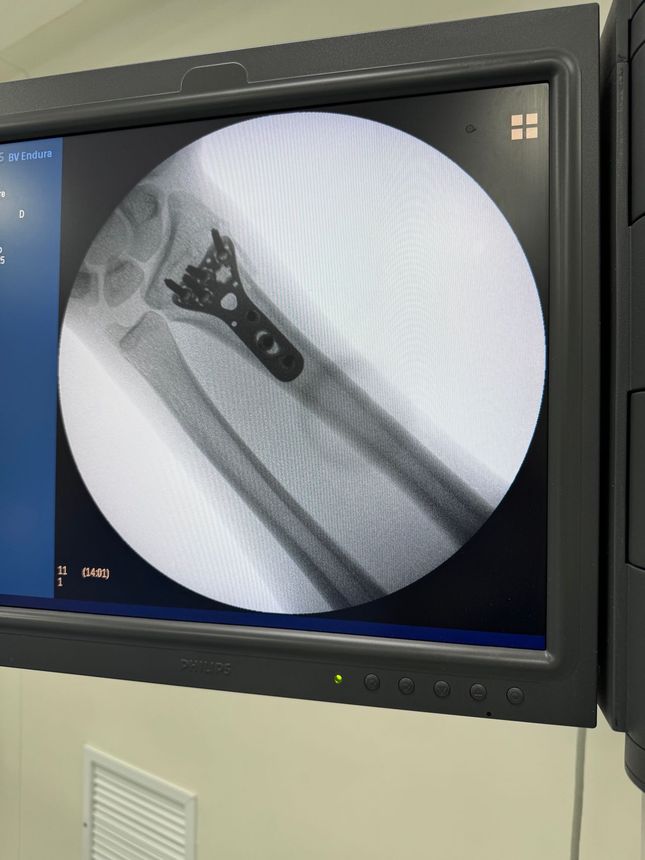 Normando De Jesús Rivera Canul-4