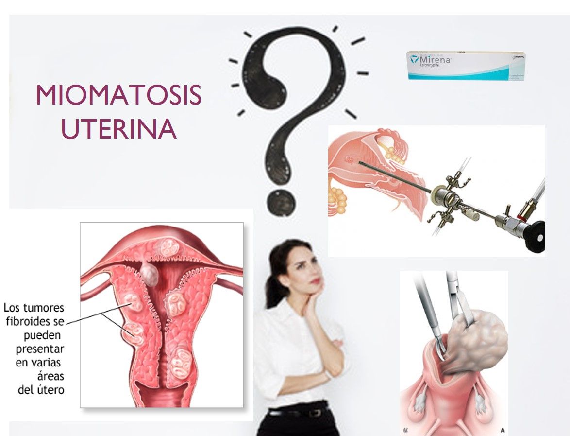 Tomás Alejandro Qué Patiño-15