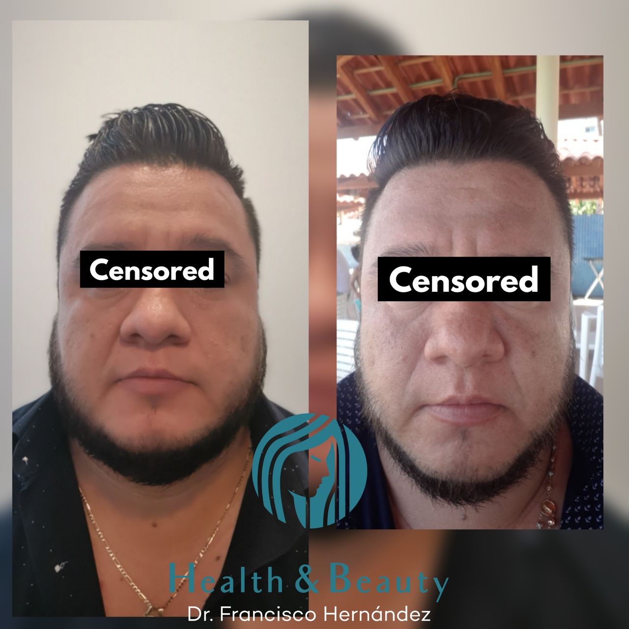 Francisco Hernández Gómez Crespo-81