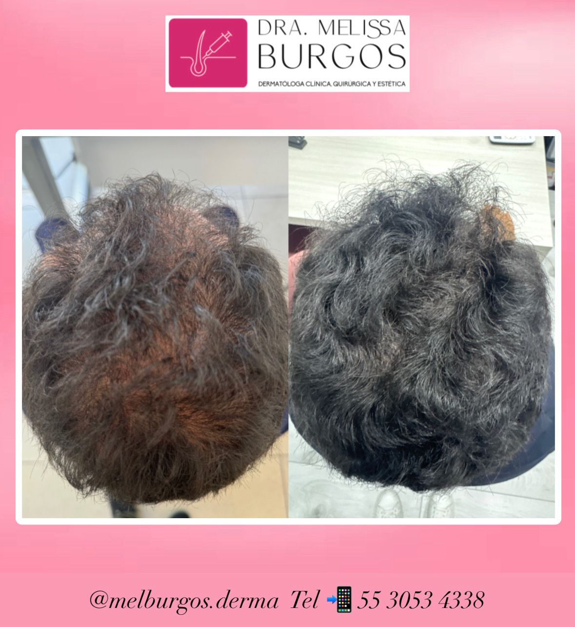 Melissa Burgos Romero-1