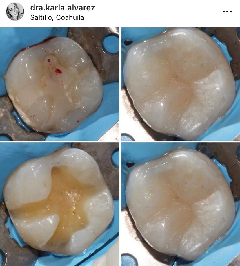 Karla Alvarez Treviño-18