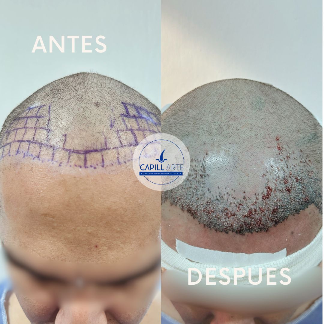 Adrian Hernandez Lopez-31