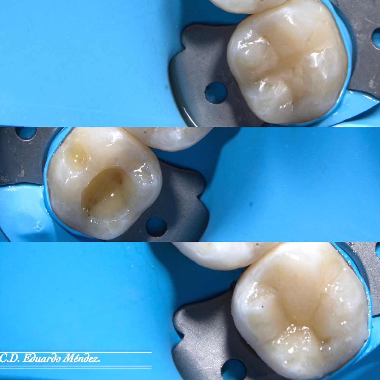 Hervin Eduardo Mendez Borrego-1