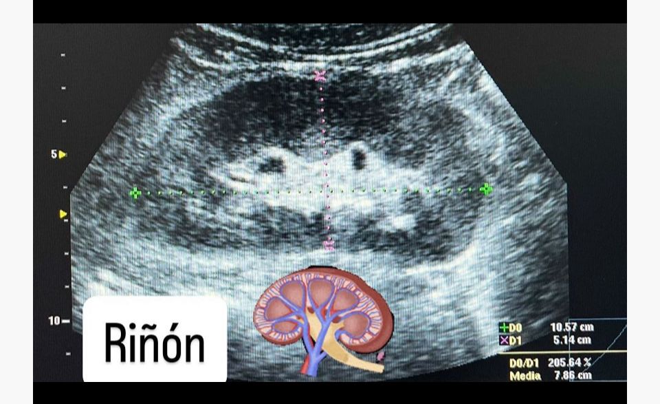 Ana Itzel Gaona Guevara-4