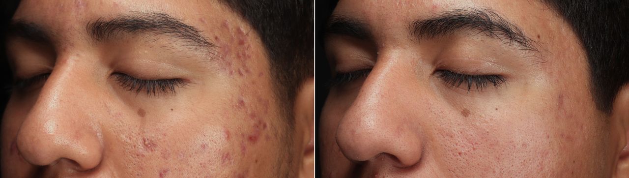 Lauro Francisco Varela Coronado-0