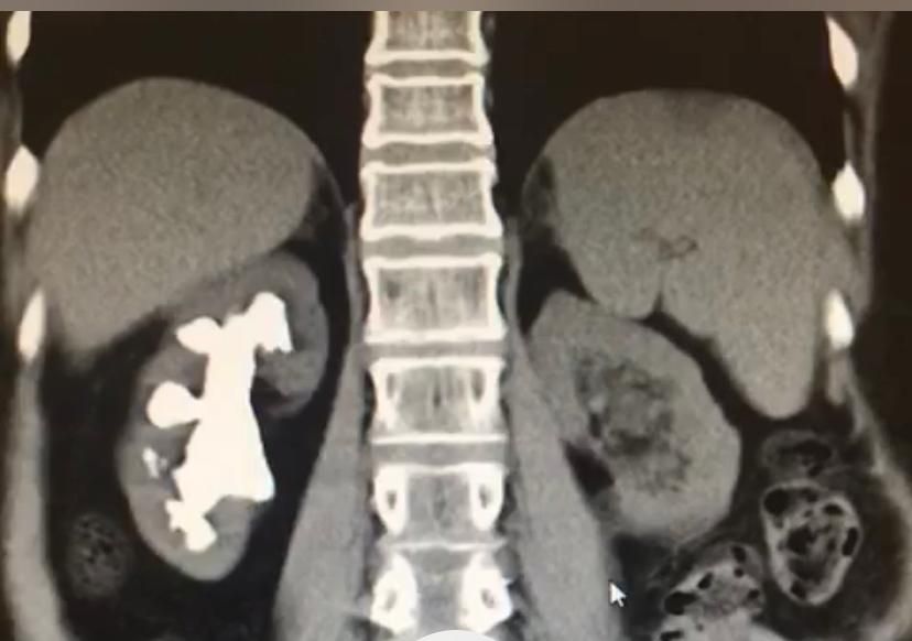 Francisco Emmanuel Navarrete Hernández-12