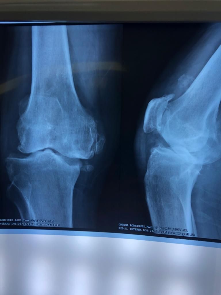 Aecio Madrigal Méndez-17