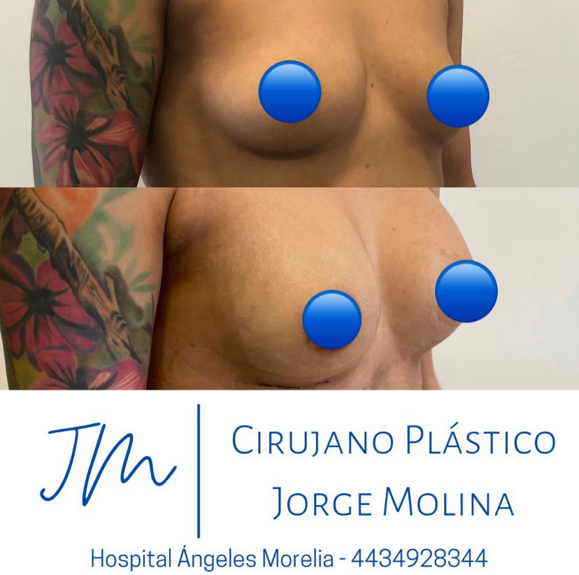 Jorge Eduardo Molina Ortega-13