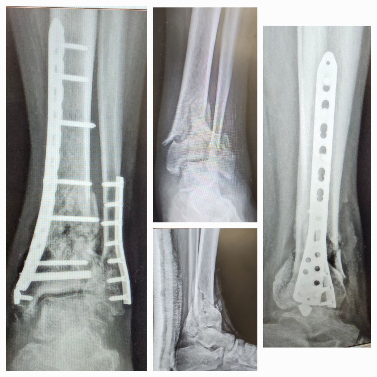 Amando Ramirez Zavala-10
