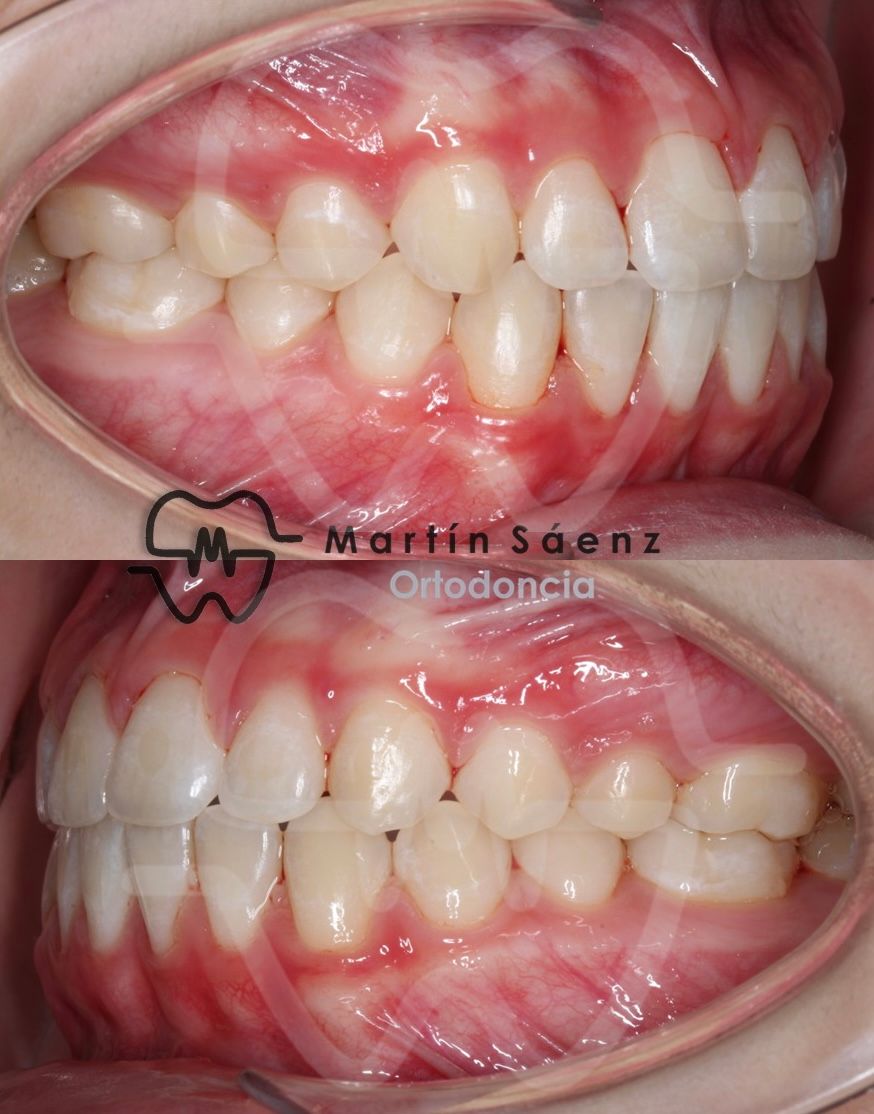 Martín Sáenz Zárate-14