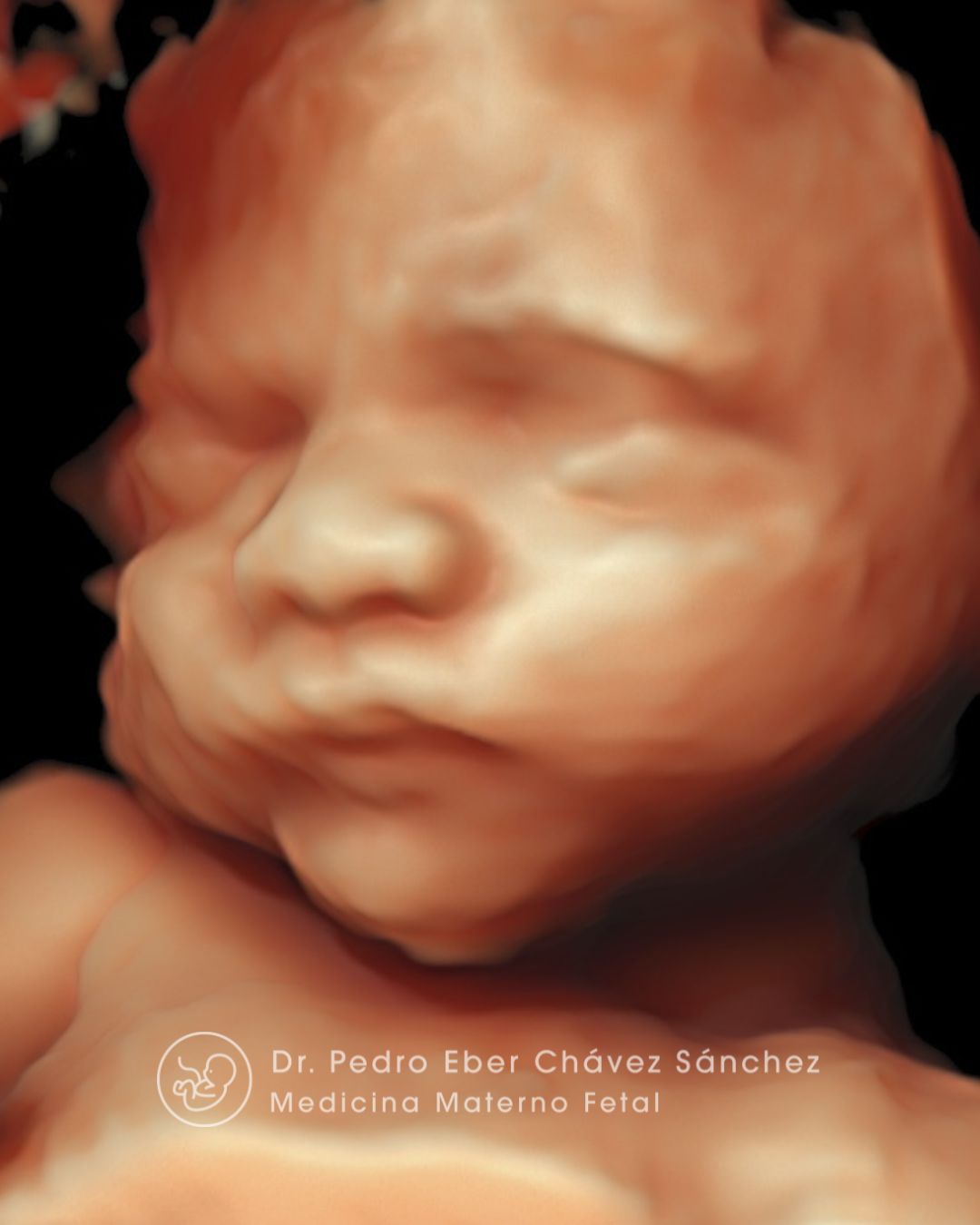 Pedro Eber Chávez Sánchez-2