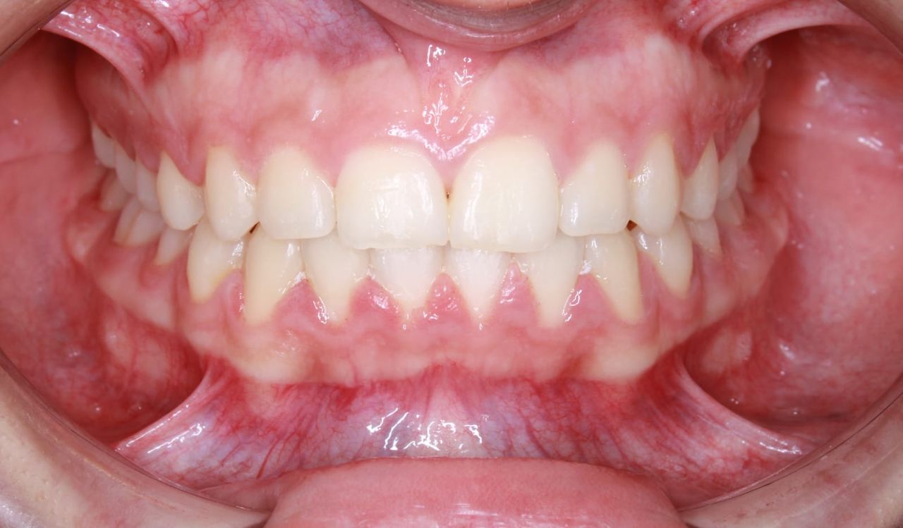 Oliver Oyim Alvarez Ballona-1