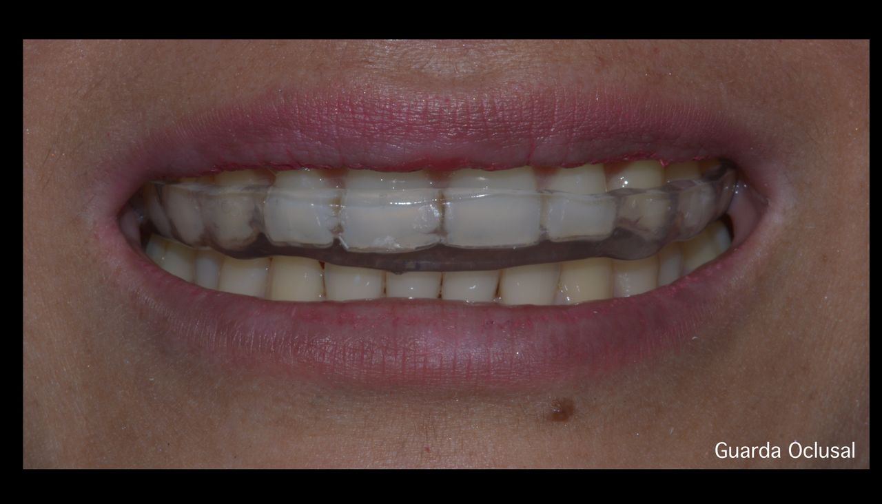 María Fernanda González Gastelum-72