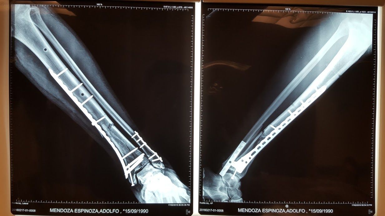 José Antonio Algarín Reyes-25