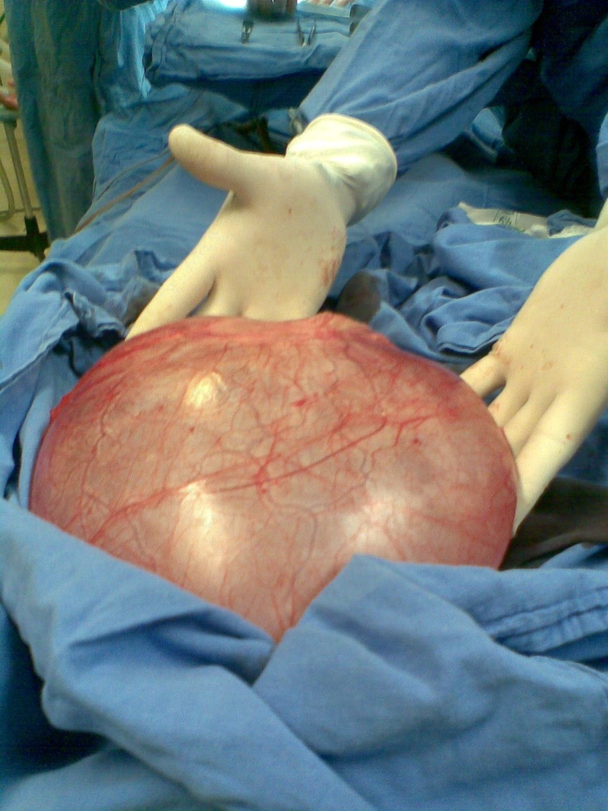 Alma Delia Arce Romero-16