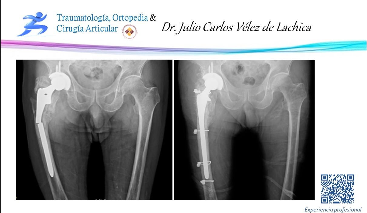 Julio Carlos Vélez De Lachica-3