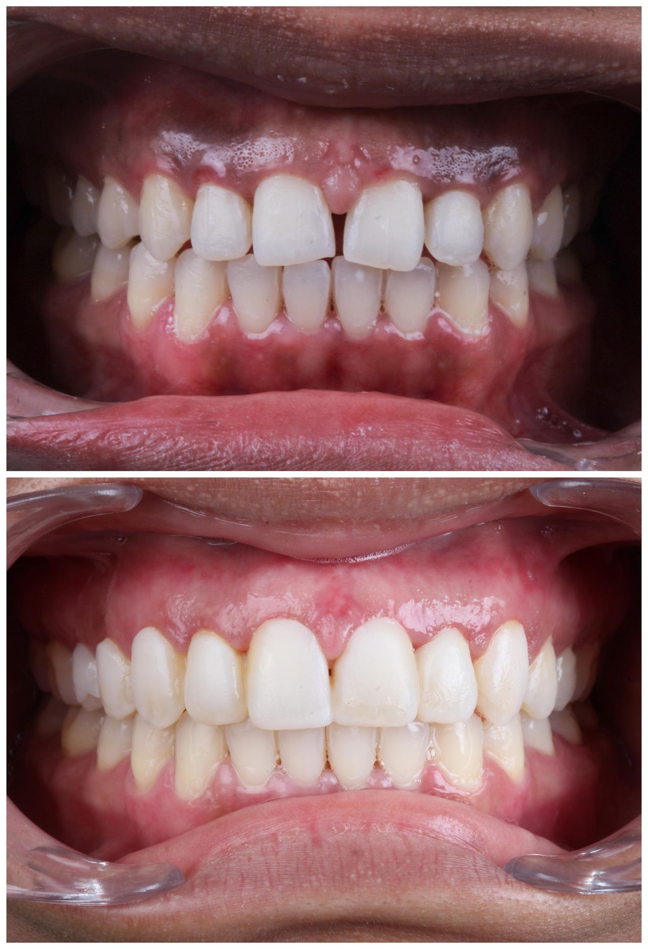 Hugo Enrique Aguilar Lamas-95