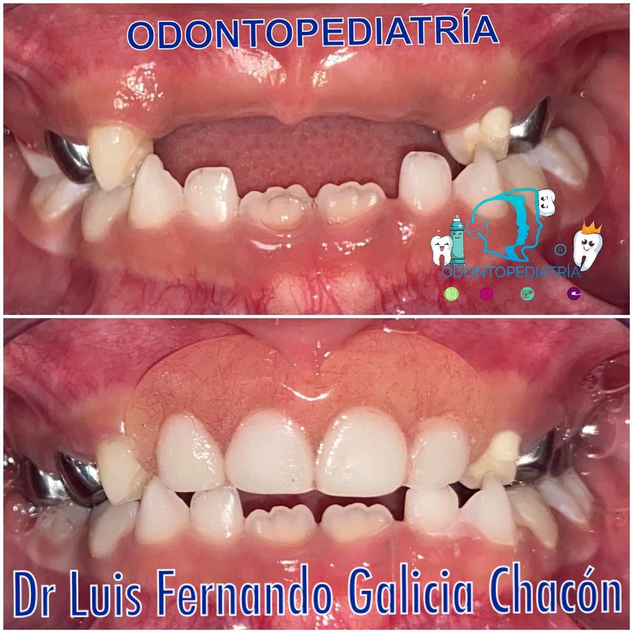 Luis Fernando Galicia Chacón-21