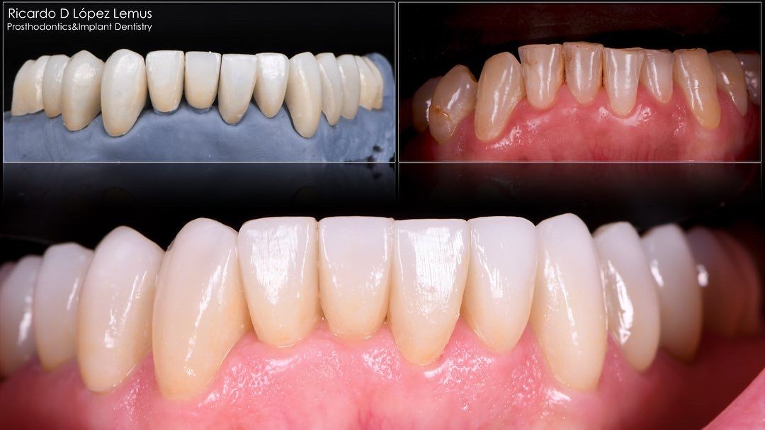 Ricardo López Lemus-25