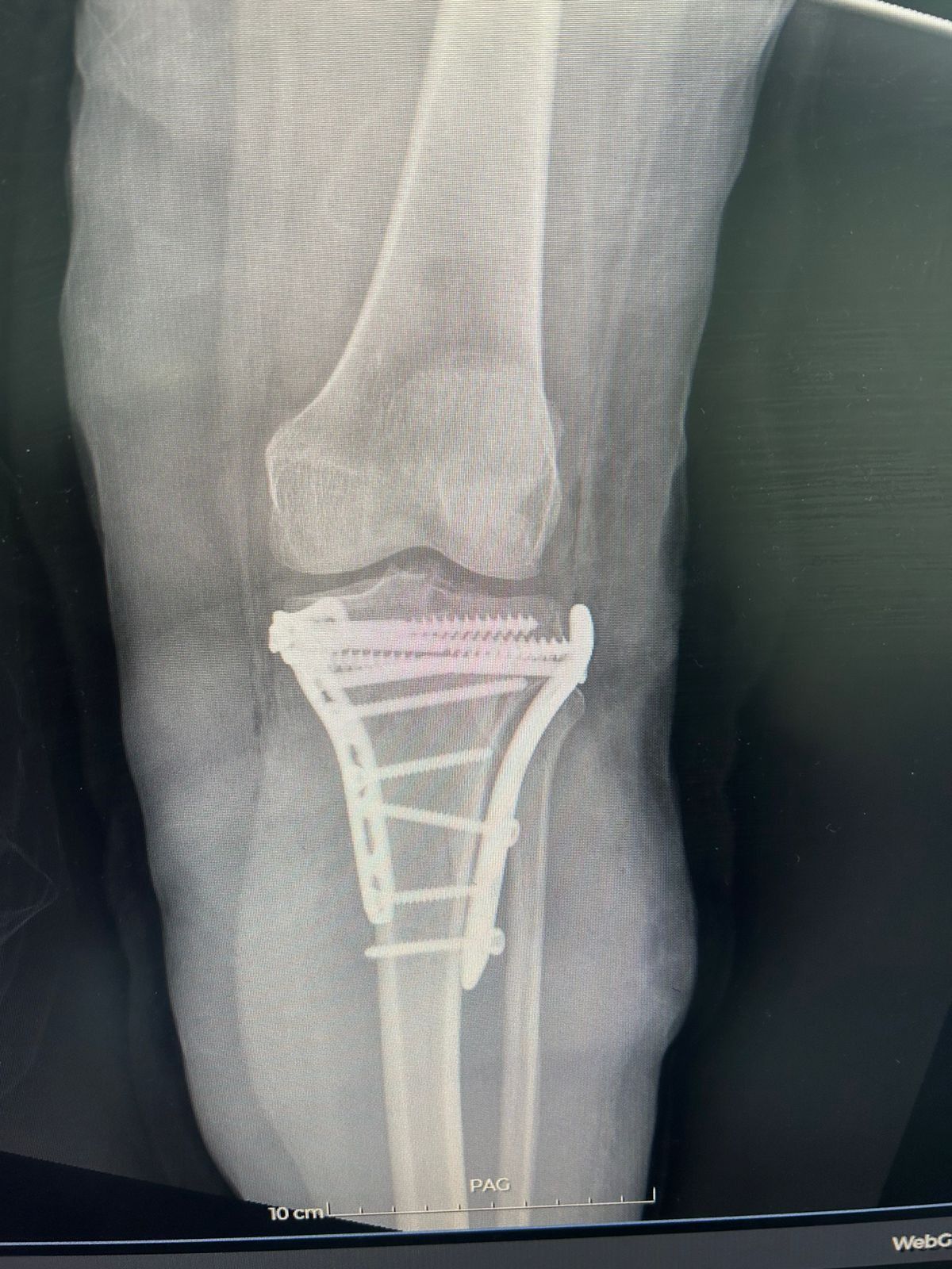 Leonardo Isaac Re-12